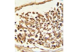 Formalin-fixed and paraffin-embedded human Testis tissue reacted with JMJD2B Antibody (N-term) followed which was peroxidase-conjugated to the secondary antibody, followed by DAB staining.