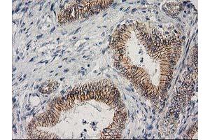 Image no. 9 for anti-Catenin (Cadherin-Associated Protein), beta 1, 88kDa (CTNNB1) antibody (ABIN1496888)