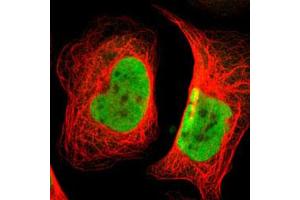 Immunofluorescent staining of U-2 OS with SMARCE1 polyclonal antibody  (Green) shows positivity in nucleus but excluded from the nucleoli. (SMARCE1 anticorps)