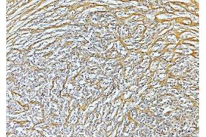 IHC analysis of Collagen VI/COL6A2 using anti-Collagen VI/COL6A2 antibody (ABIN7601439).