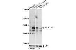 Western blot analysis of extracts of SH-SY5Y and C6 cells, using Phospho-MAPT-S404 antibody (ABIN2987503) at 1/2000 dilution. (MAPT anticorps  (pSer404))