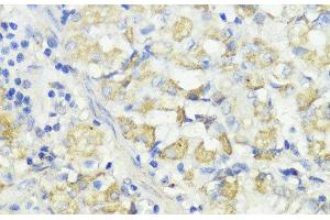 Immunohistochemistry of paraffin-embedded Human stomach using CTSB Polyclonal Antibody at dilution of 1:100 (40x lens). (Cathepsin B anticorps)