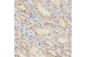 Immunohistochemistry of paraffin-embedded human kidney using GGA2 antibody at dilution of 1:200 (x400 lens)