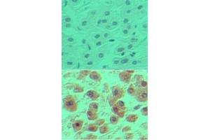 anti-POU Domain, Class 2, Transcription Factor 1 (POU2F1) (AA 1-50) antibody