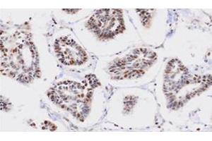 Immunohistochemistry (IHC) image for anti-Protein Phosphatase, Mg2+/Mn2+ Dependent, 1G (PPM1G) (AA 317-546) antibody (ABIN317552) (PPM1G anticorps  (AA 317-546))