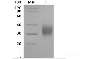 Western Blotting (WB) image for Fc Fragment of IgG, Low Affinity IIIa, Receptor (CD16a) (FCGR3A) protein (His tag) (ABIN7321023)