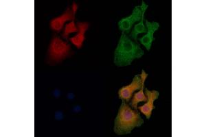 ABIN7094050 and ABIN7098094 staining Hela cells by IF/ICC. (SOAT2 anticorps  (C-Term))