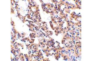 Immunohistochemistry of IL21R in rat lung with IL21R polyclonal antibody  at 10 ug/mL . (IL21 Receptor anticorps  (AA 97-111))