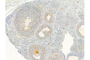 ABIN6255661 and ABIN6267025 at 1/100 staining Rat ovary tissue by IHC-P. (AKT1 anticorps  (pThr308))