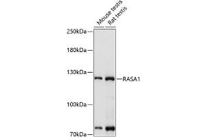 Western blot analysis of extracts of various cell lines, using R antibody (ABIN3022296, ABIN3022297, ABIN3022298 and ABIN6218715) at 1:1000 dilution. (RASA1 anticorps  (AA 140-220))