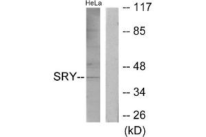 Western blot analysis of extracts from HeLa cells, using SRY antibody. (SRY anticorps  (Internal Region))
