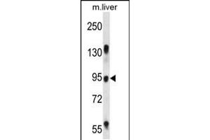 Western blot analysis in mouse liver tissue lysates (35ug/lane). (RASAL1 anticorps  (AA 309-337))