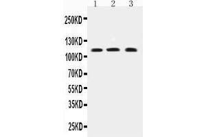 Western Blotting (WB) image for anti-Transient Receptor Potential Cation Channel, Subfamily C, Member 4 (TRPC4) (AA 961-977), (C-Term) antibody (ABIN3042531) (TRPC4 anticorps  (C-Term))