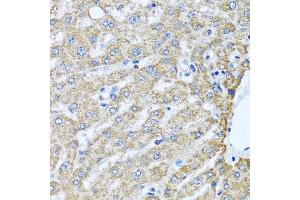 Immunohistochemistry of paraffin-embedded human liver using TMEM189 antibody (ABIN6134447, ABIN6149262, ABIN6149263 and ABIN6224423) at dilution of 1:100 (40x lens). (TMEM189 anticorps  (C-Term))