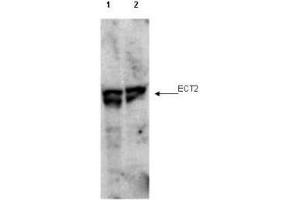 Western blot using  affinity purified anti-ECT2 pT790 antibody shows detection of endogenous phosphorylated ECT2 (arrowhead) present in cell lysates from interphase (lane 1) and mitotic (lane 2) HeLa cells.