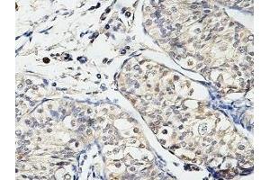 IHC analysis of formalin-fixed paraffin-embedded fetal testis, using USP29 antibody (1/100 dilution). (USP29 anticorps  (AA 15-215))