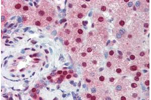 Human Liver (formalin-fixed, paraffin-embedded) stained with SSB antibody ABIN462226 followed by biotinylated goat anti-rabbit IgG secondary antibody ABIN481713, alkaline phosphatase-streptavidin and chromogen.