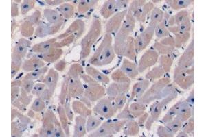 Detection of CASP9 in Human Cardiac Muscle Tissue using Polyclonal Antibody to Caspase 9 (CASP9)