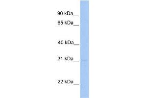 WB Suggested Anti-MMD2 Antibody Titration: 0. (MMD2 anticorps  (N-Term))