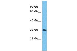 Host:  Rabbit  Target Name:  ZNF625  Sample Type:  Stomach Tumor lysates  Antibody Dilution:  1. (ZNF625 anticorps  (Middle Region))