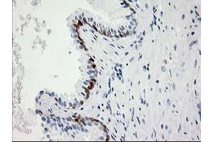 Image no. 6 for anti-Hydroxyprostaglandin Dehydrogenase 15-(NAD) (HPGD) antibody (ABIN1496363) (HPGD anticorps)