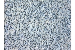 Image no. 1 for anti-Crystallin, alpha B (CRYAB) antibody (ABIN1497645) (CRYAB anticorps)