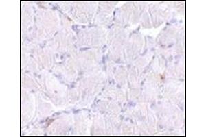 Immunohistochemistry of LIMP2 in human skeletal muscle tissue with this product at 10 μg/ml. (SCARB2 anticorps  (C-Term))