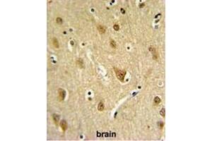 ST8SIA4 Antibody (Center) IHC analysis in formalin fixed and paraffin embedded brain tissue followed by peroxidase conjugation of the secondary antibody and DAB staining.