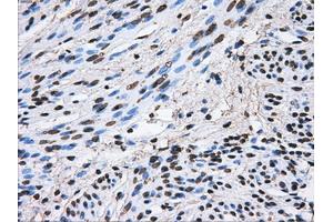 Image no. 11 for anti-ATP Synthase, H+ Transporting, Mitochondrial F1 Complex, beta Polypeptide (ATP5B) antibody (ABIN1496766)