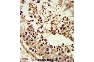 Immunohistochemistry (IHC) image for anti-TATA Box Binding Protein (TBP) antibody (ABIN3002745)