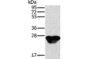 Western blot analysis of Mouse heart tissue, using MYL3 Polyclonal Antibody at dilution of 1:500 (MYL3/CMLC1 anticorps)