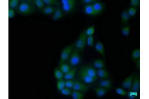 Immunofluorescence staining of Hela cells with ABIN7140130 at 1:133, counter-stained with DAPI. (TBK1 anticorps  (AA 644-661))
