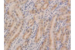 DAB staining on IHC-P; Samples: Rat Kidney Tissue (GSTa5 anticorps  (AA 1-221))