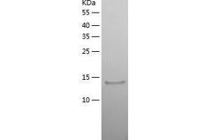 Western Blotting (WB) image for Dual Specificity Phosphatase 23 (DUSP23) (AA 1-150) protein (His-IF2DI Tag) (ABIN7122712)