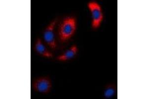 Immunofluorescent analysis of MKK6 staining in Hela cells. (MAP2K6 anticorps  (N-Term))
