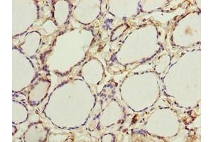 Immunohistochemistry of paraffin-embedded human thyroid tissue using ABIN7166396 at dilution of 1:100 (PADI3 anticorps  (AA 1-664))