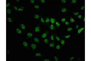 Immunofluorescence staining of Hela cells with ABIN7127715 at 1:100,counter-stained with DAPI. (Recombinant MTOR anticorps  (pSer2481))
