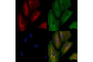 ABIN6262847 and ABIN6278586 staining  cells by IF/ICC. (KLHL3 anticorps  (N-Term))