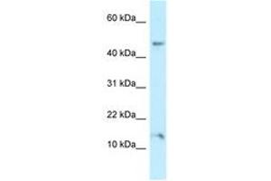 Image no. 1 for anti-Pleckstrin Homology Domain Containing, Family J Member 1 (PLEKHJ1) (AA 86-135) antibody (ABIN6747910) (GNRPX anticorps  (AA 86-135))