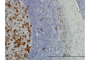 Immunoperoxidase of monoclonal antibody to TYMS on formalin-fixed paraffin-embedded human tonsil.
