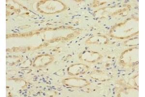 Immunohistochemistry of paraffin-embedded human kidney tissue using ABIN7161137 at dilution of 1:100 (NAE1 anticorps  (Regulatory Subunit))