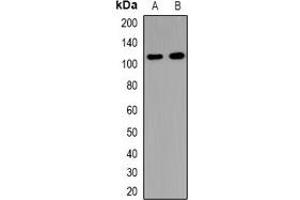 Western blot analysis of USP37 expression in HeLa (A), mouse brain (B), rat brain (C) whole cell lysates. (USP37 anticorps)