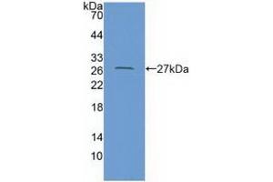 Coxsackie Adenovirus Receptor antibody  (AA 20-229)