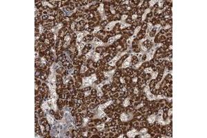 Immunohistochemical staining of human liver with ROGDI polyclonal antibody  shows strong cytoplasmic positivity in hepatocytes. (ROGDI anticorps)