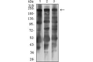 Western blot analysis using MYLK mouse mAb against PC-3 (1), C2C12 (2), and Hela (3) cell lysate. (MYLK anticorps  (AA 1375-1524))