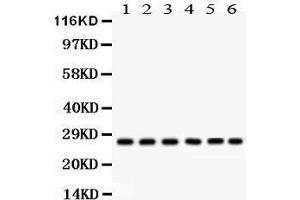 Anti- CIB1 Picoband antibody, Western blotting All lanes: Anti CIB1  at 0. (CIB1 anticorps  (AA 6-191))
