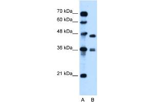 WB Suggested Anti-MPG Antibody Titration:  0. (MPG anticorps  (C-Term))