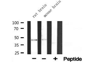 Western blot analysis of extracts of various tissue ,using ACAT1 antibody.