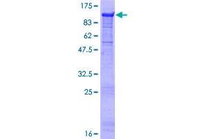 Image no. 1 for Mesoderm Induction Early Response 1, Family Member 3 (MIER3) (AA 1-522) protein (GST tag) (ABIN1310936)