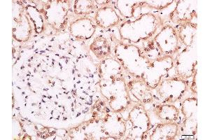 Formalin-fixed and paraffin embedded human kidney labeled with Anti-Torc1 (Ser151) Polyclonal Antibody, Unconjugated  at 1:200 followed by conjugation to the secondary antibody and DAB staining.
